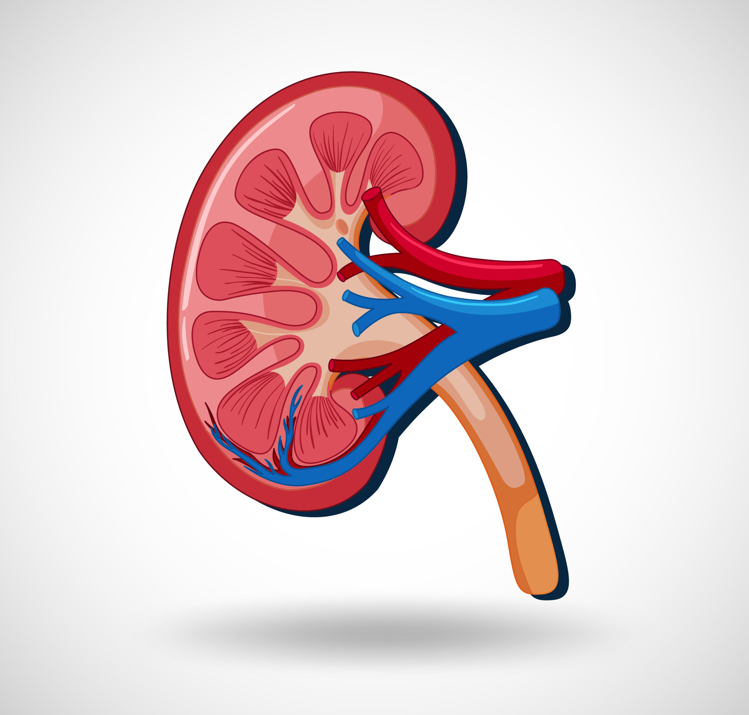 Kidney Transplantation