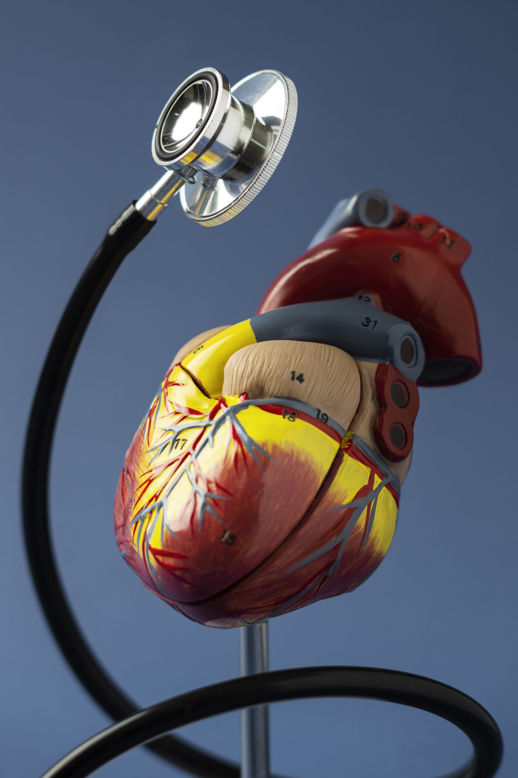 Heart Transplant